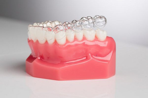 Niềng răng trong suốt Invisalign có hiệu quả không ? hinh-anh-minh-hoa-chinh-nha-nieng-rang-invisalign
