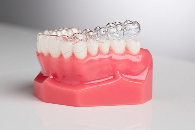 niềng răng khay trong niềng răng khay trong