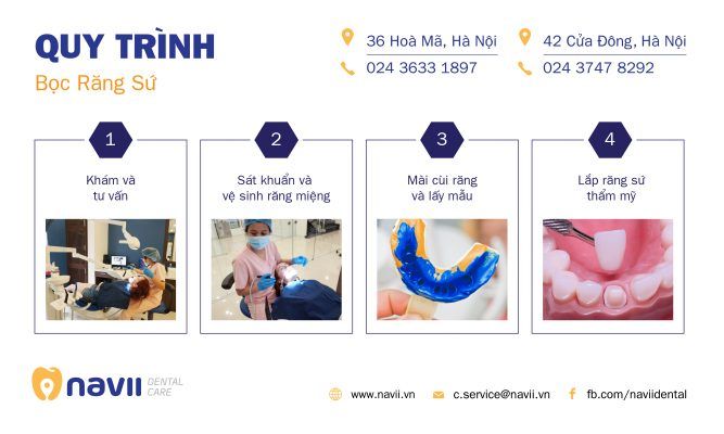bọc răng sứ giá bao nhiêu bọc răng sứ giá bao nhiêu