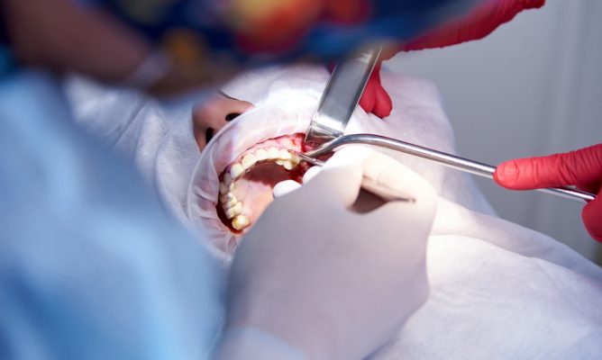 nen-ghep-xuong-o-dau