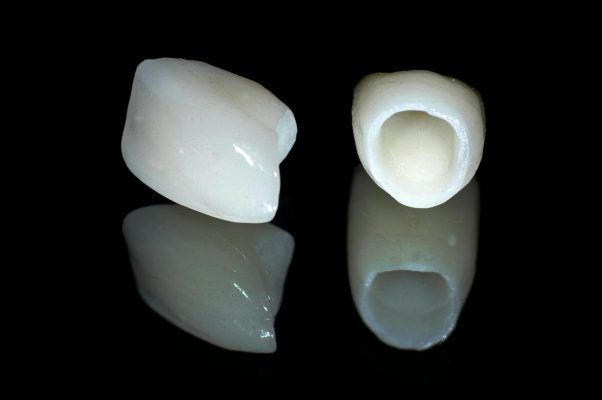 Porcelain crowns 