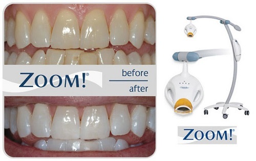 phillips-zoom-teeth-whitening