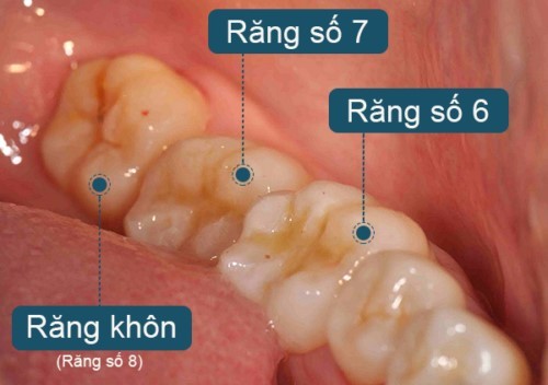 rang-cam-co-nen-nho-khong
