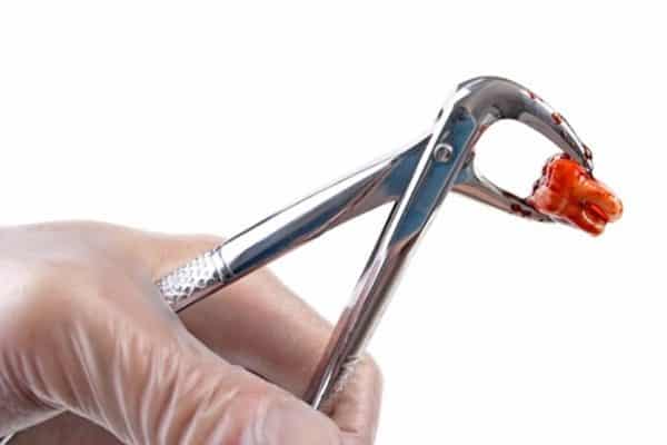 nho-rang-xong-nen-an-gi