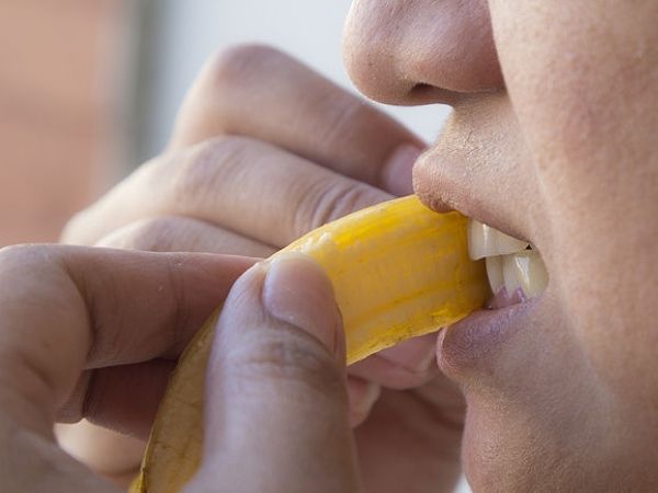 teeth-whitening