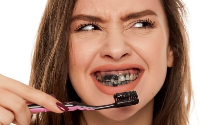 Tẩy trắng răng bằng than hoạt tính có tốt không? – Navii Blog