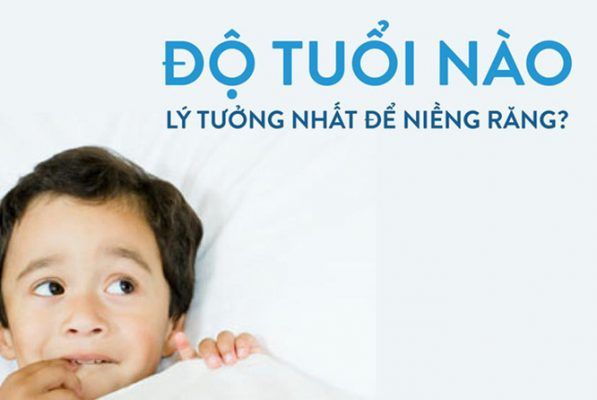 giá niềng răng cho trẻ em