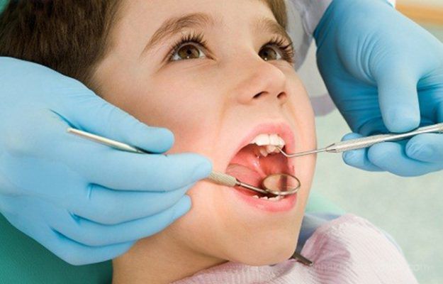 chỉnh nha cho trẻ em